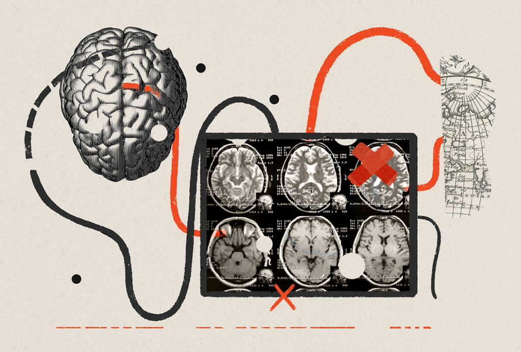 Curvy lines link brain scans and a world map.