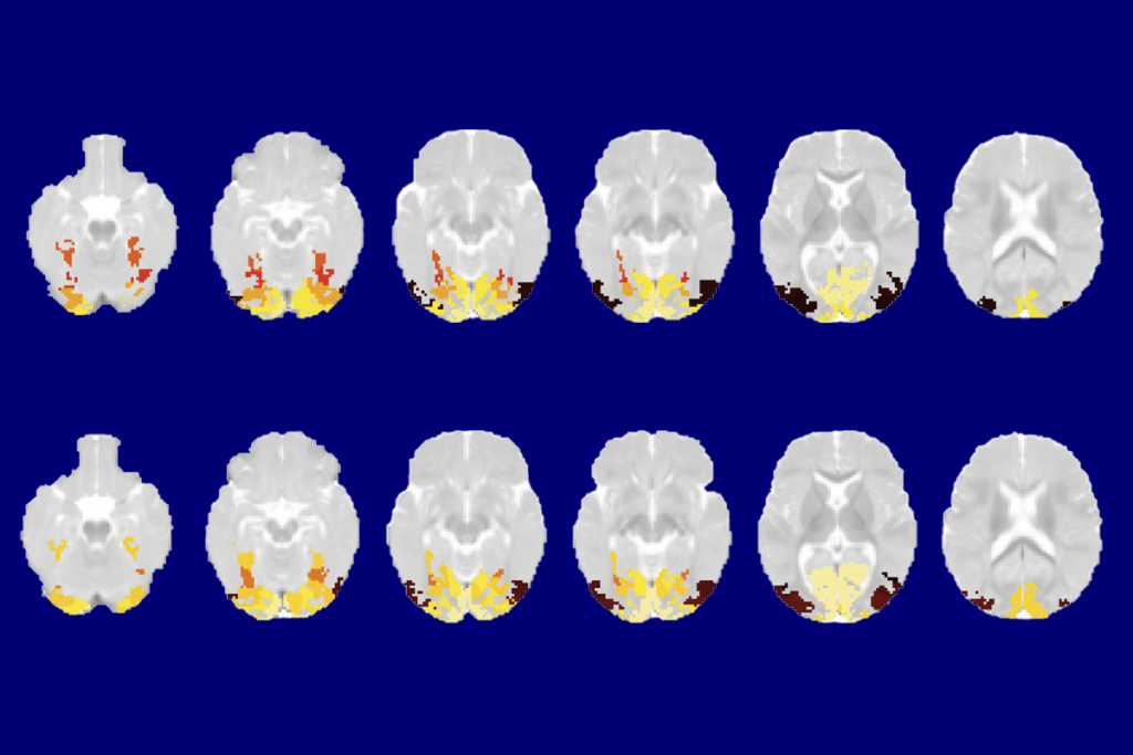 Research image of brain activity in infants.