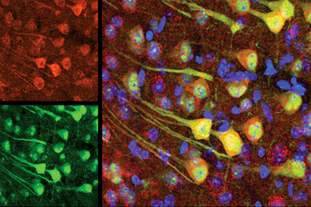 Research image of neuronal proteins in mice.