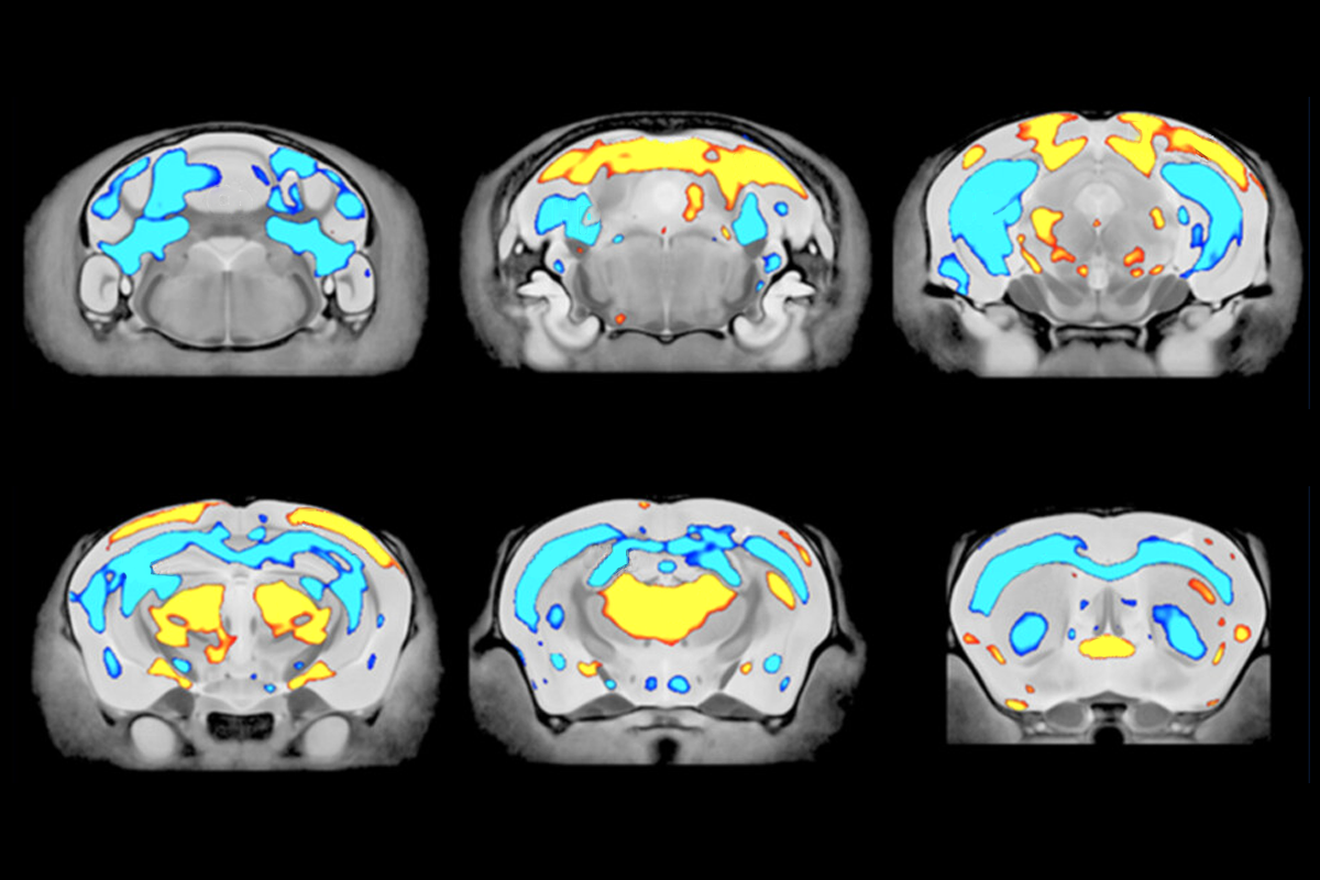 Research image of mice brains.