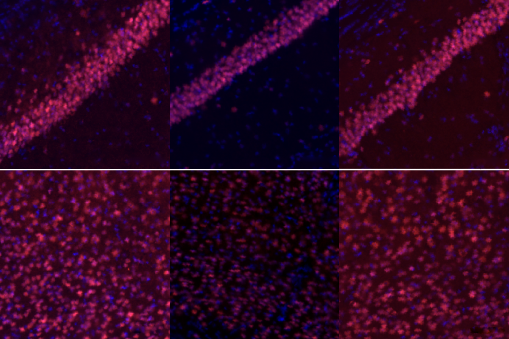 Research image of CHD3 protein levels in mice brains.