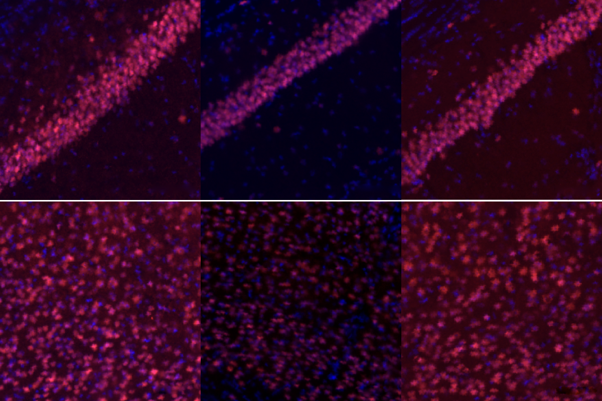 Research image of CHD3 protein levels in mice brains.
