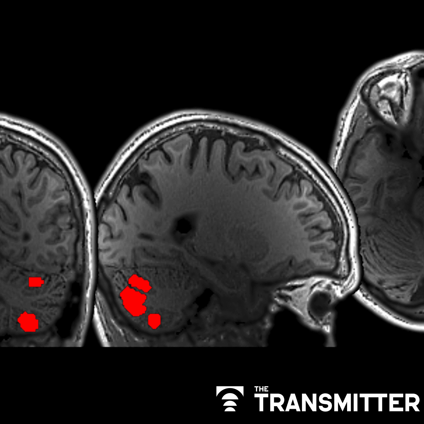 Cerebellum responds to language like cortical areas episode artwork