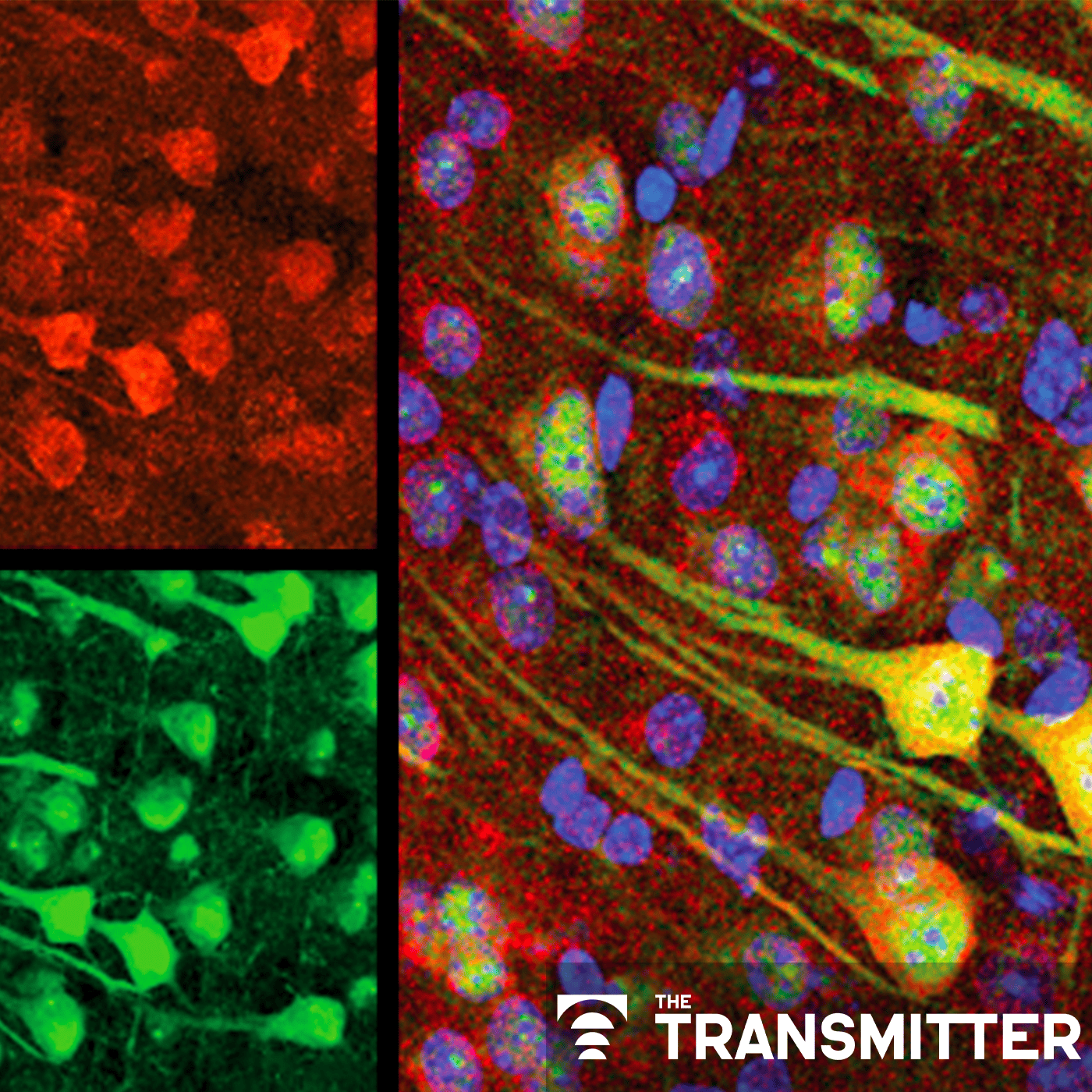 Aging neurons outsource garbage disposal, clog microglia episode artwork