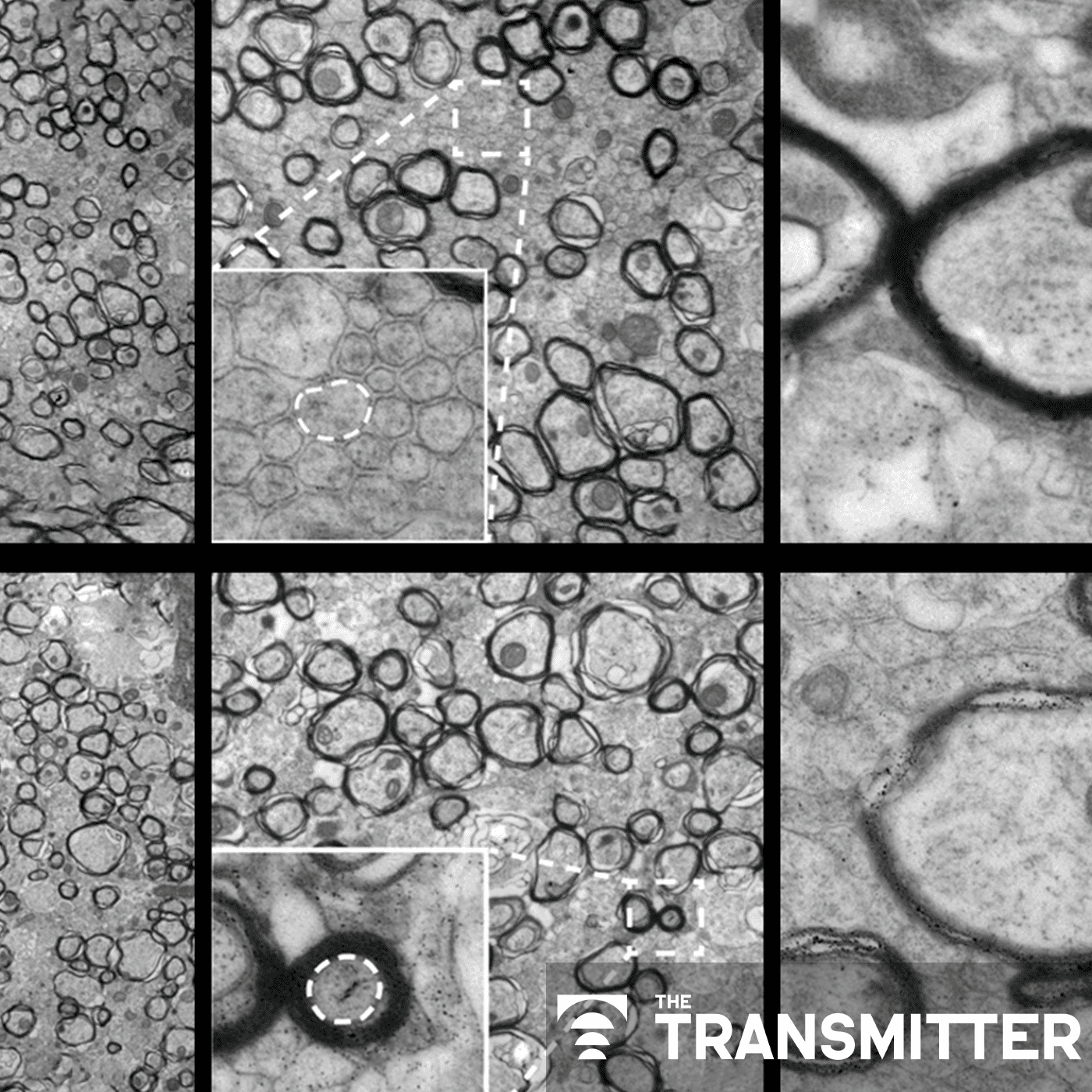 Oligodendrocytes need mechanical cues to myelinate axons correctly episode artwork