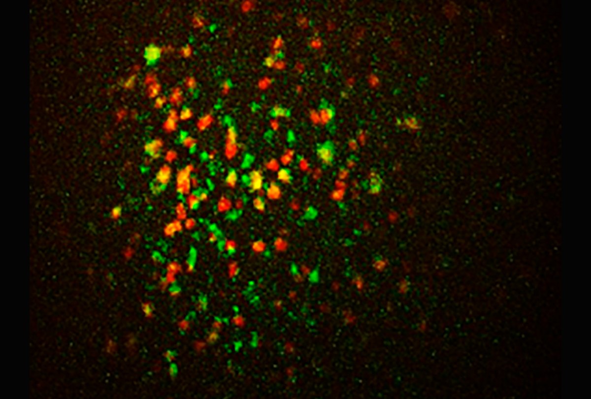 Research image of dual-color calcium imaging in red and green of genetically labeled cells.