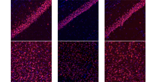 Esperanza para el autismo
