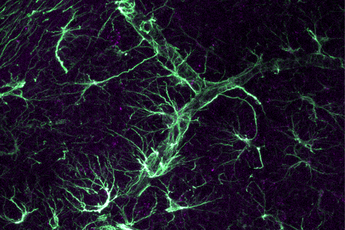 Research image of astrocytes in the mouse brain.