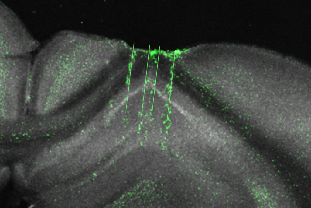 Research image of a mouse hippocampus.