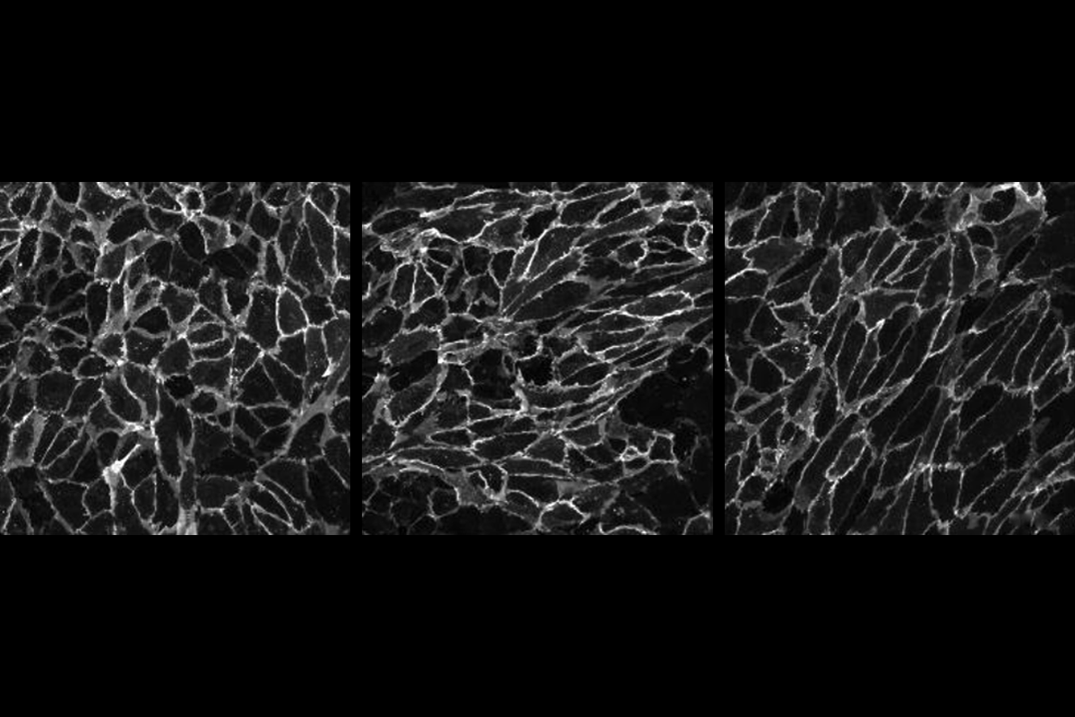 Research image of human endothelial cells grown in vitro.
