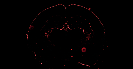 Las células 'olvidadas' del cerebro que nos ayudan a entender el autismo