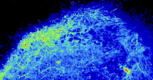 新型类器官集合体模拟血清素神经调控，探索脑疾病机制