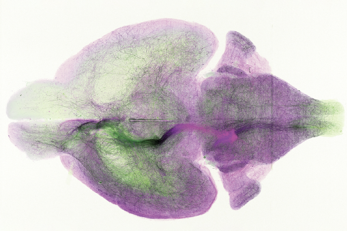 Research image of locus coeruleus