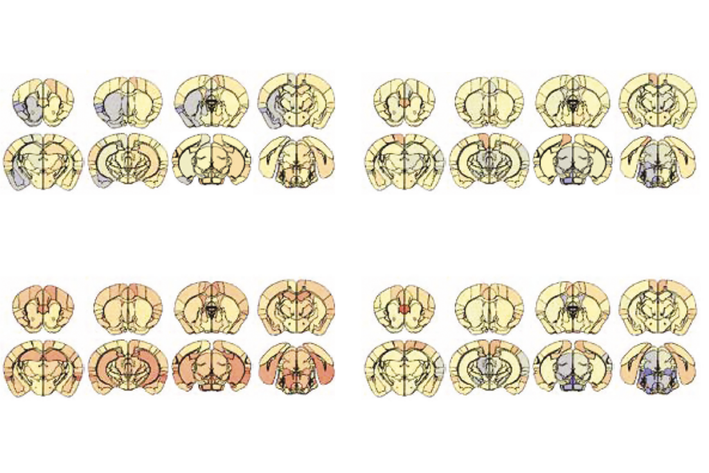 Research image showing brain volume changes in mice