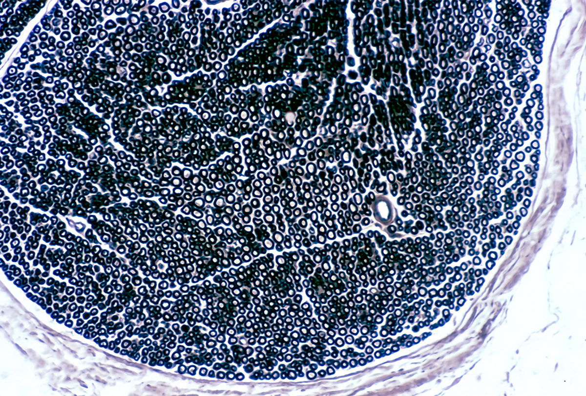 Myelin research image.