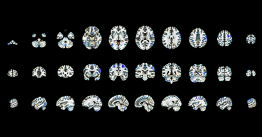Imagen ilustrativa: Descubriendo las pistas genéticas y ambientales del autismo — Investigación
