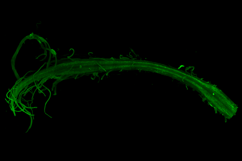 Research image of brain cells involved with Amyotrophic lateral sclerosis (ALS) illuminated through genetic tools