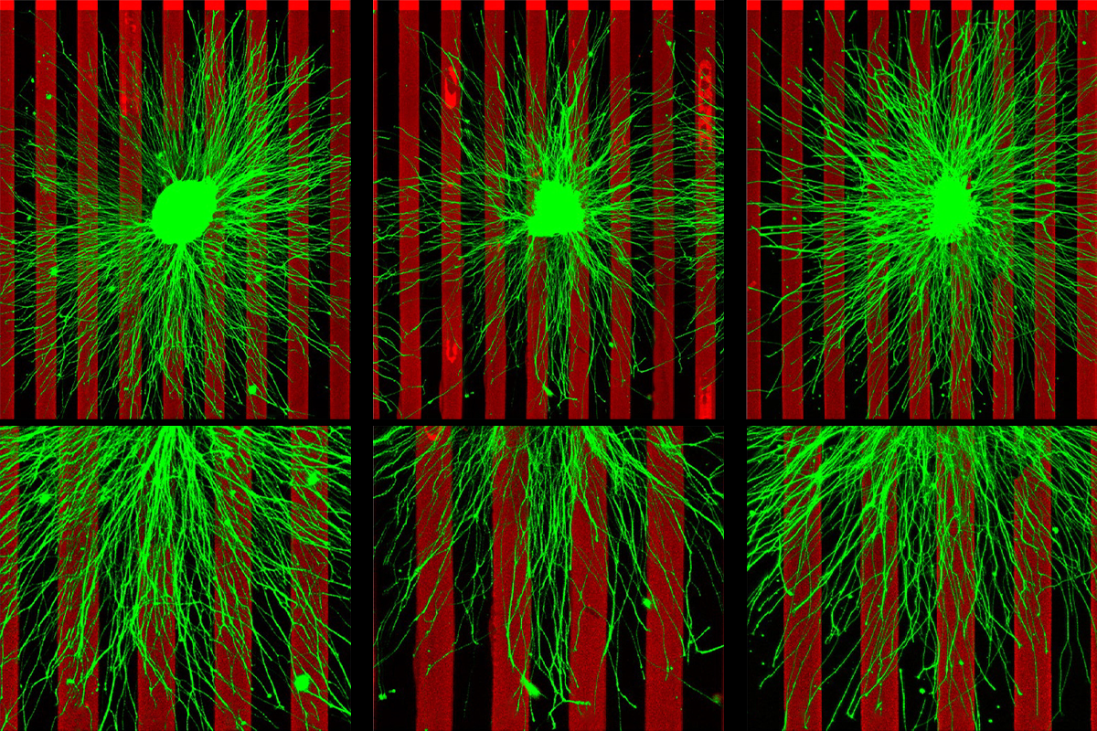 Research image of cell-surface protein LPHN2