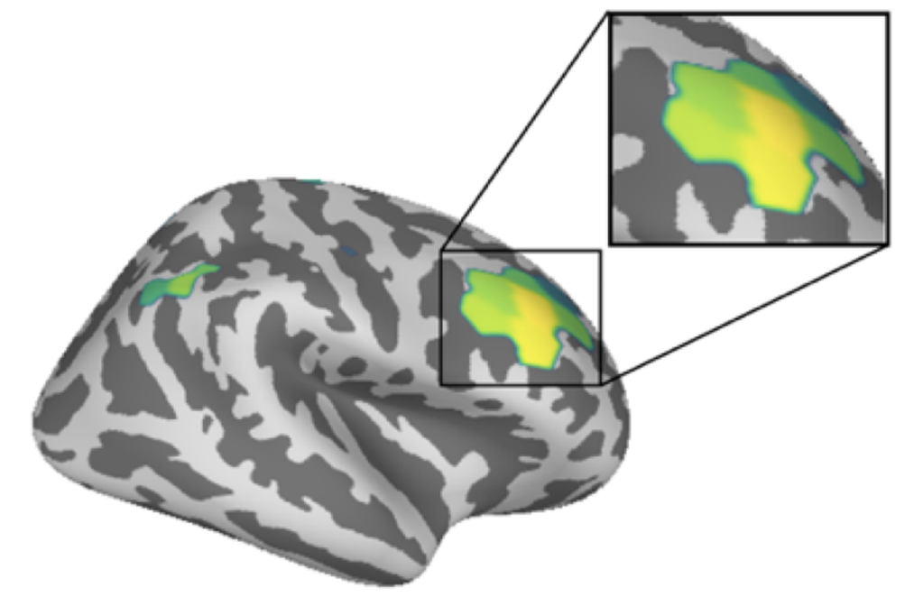 Research image of cortical excitation–inhibition balance.