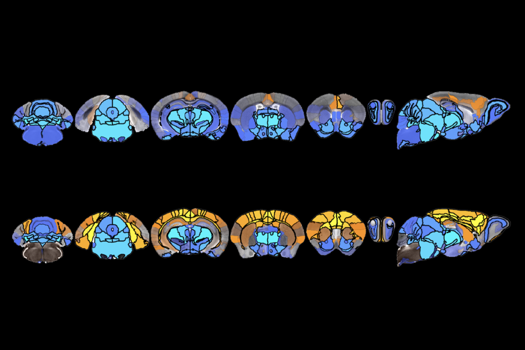 Research image of mice brains, showing larger cerebral cortices and smaller subcortical volumes.