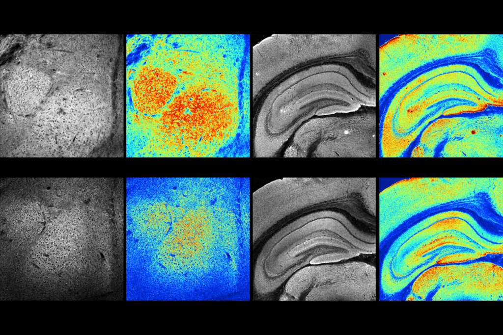 Research image of mitochondrial activity in the mouse amygdala and hippocampus.