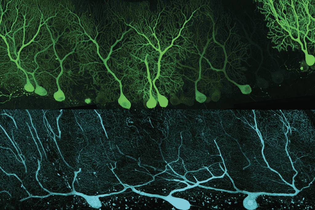 Research image of mouse and human Purkinje cells.