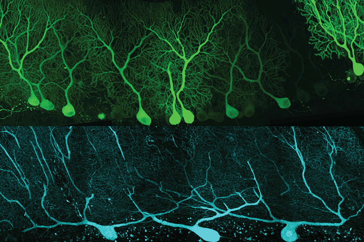 Research image of mouse and human Purkinje cells.