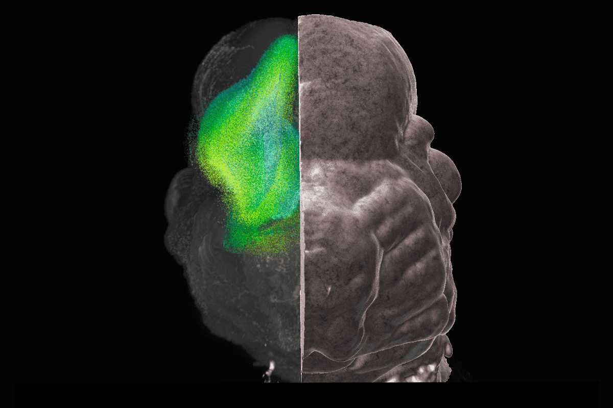 Research image of proliferating neural cells.