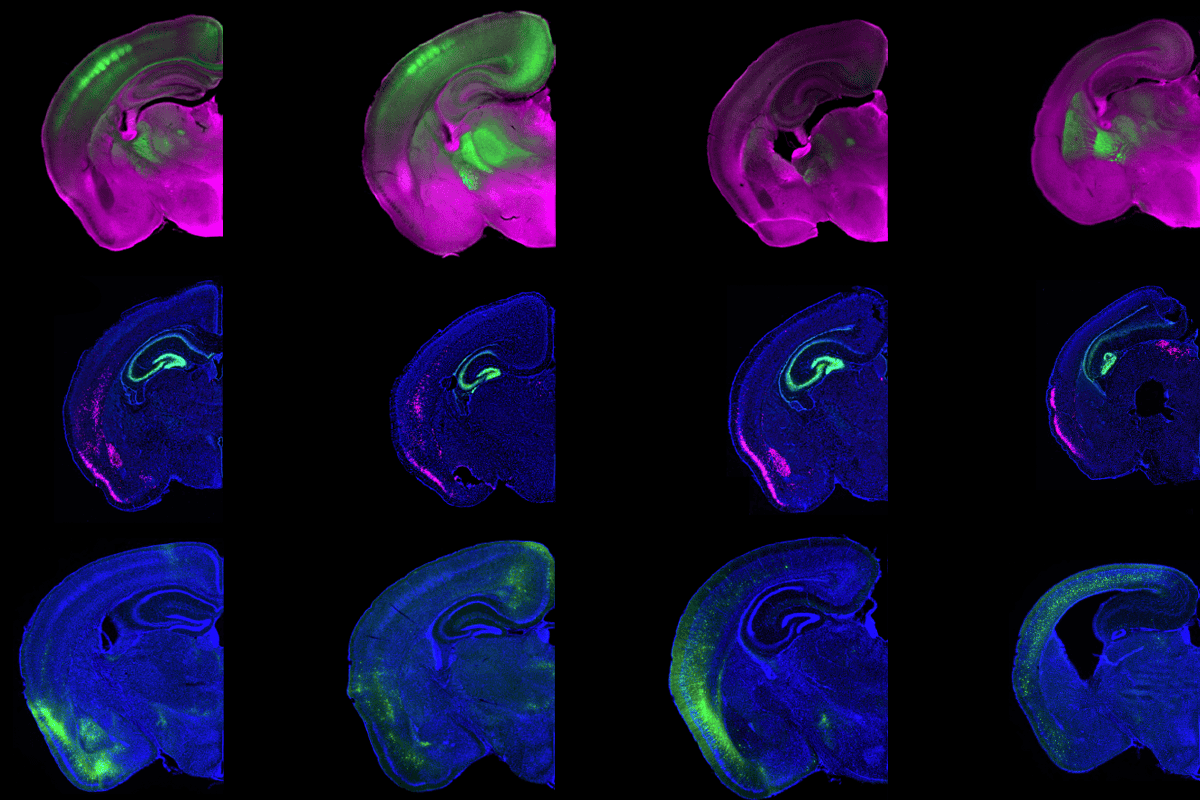 Cortical territories compete in developmental space race