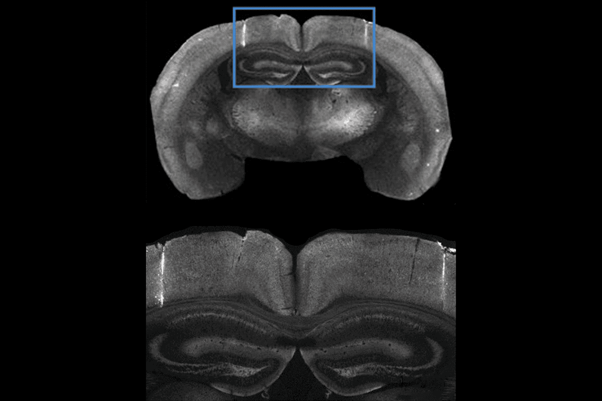 Research image of mouse brain.