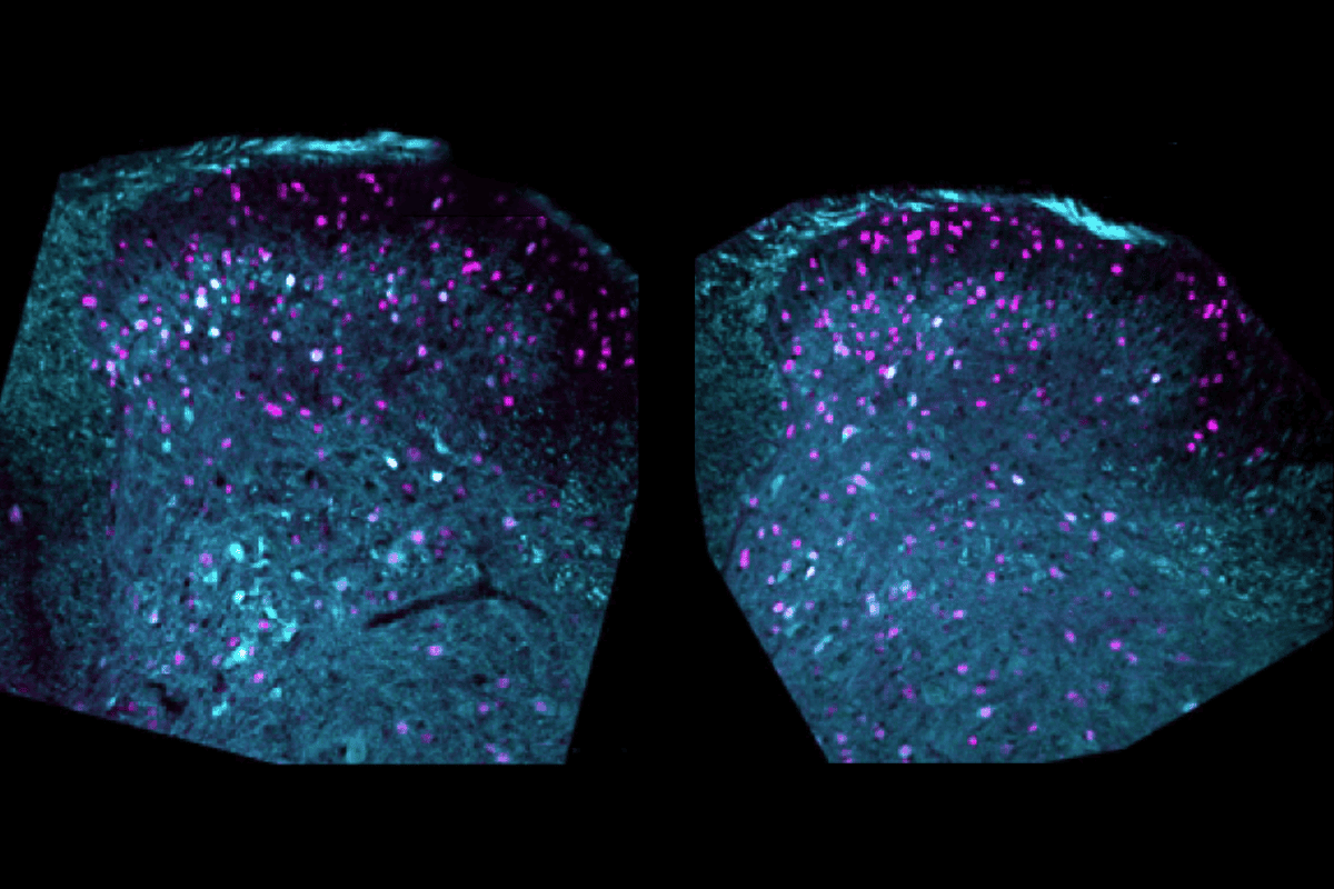 Research image of inhibitory neurons and parvalbumin-expressing neurons.