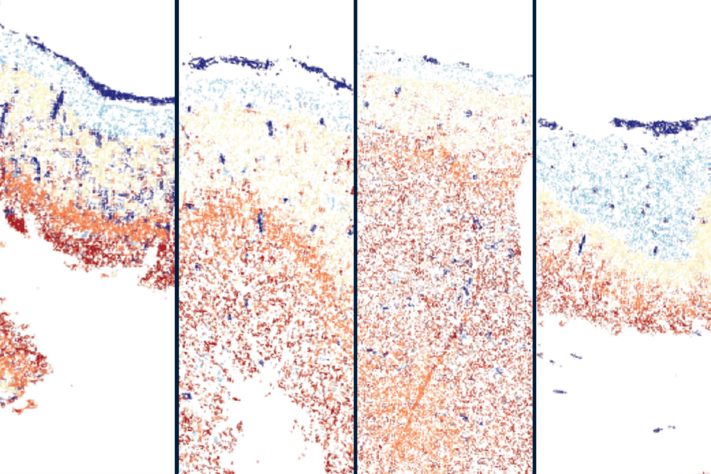 Single-cell spatial transcriptomics chart maps of cell types.