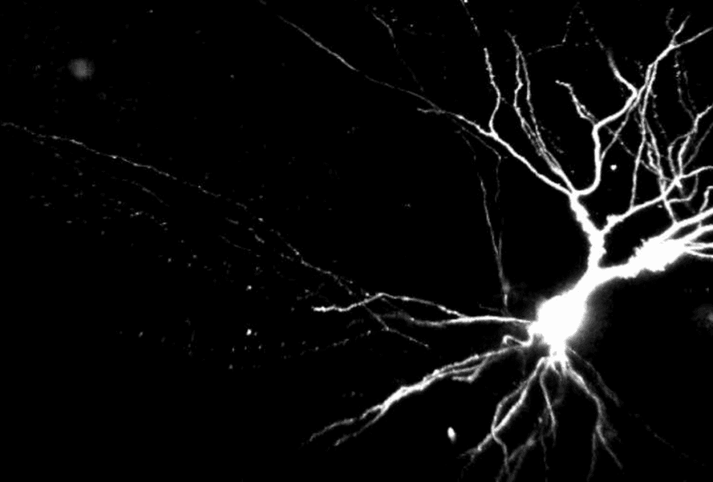 Dendrite.