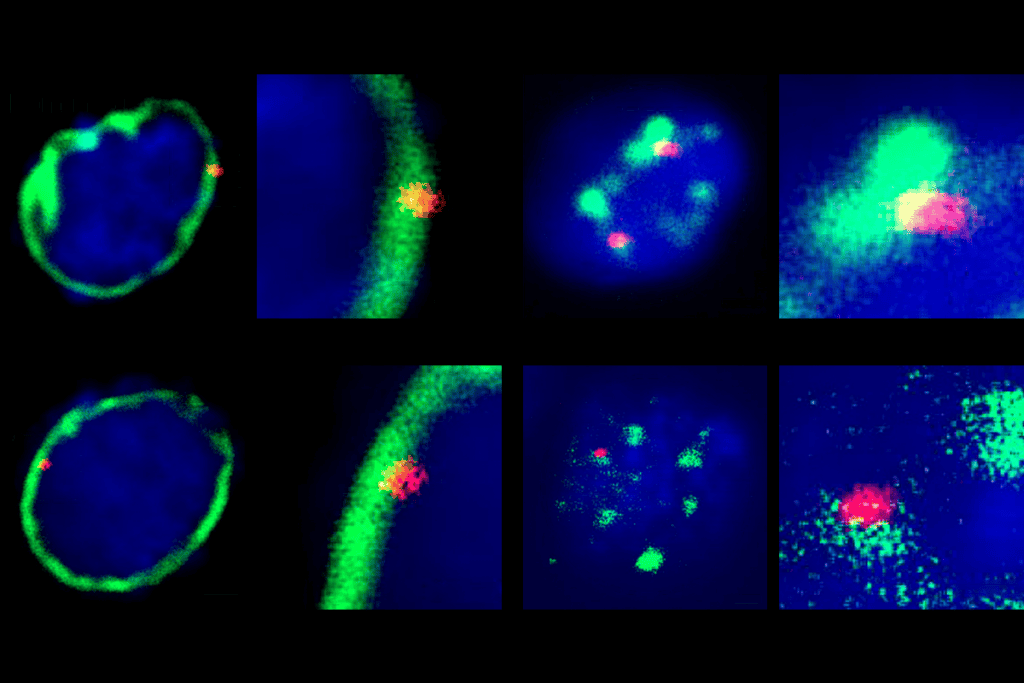 Neuronal genes SATB2 and MEF2C.