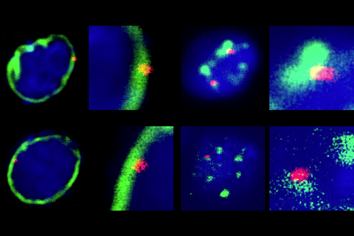 Neuronal genes SATB2 and MEF2C.