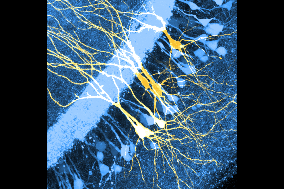 St18-positive neurons and St18-negative neurons.