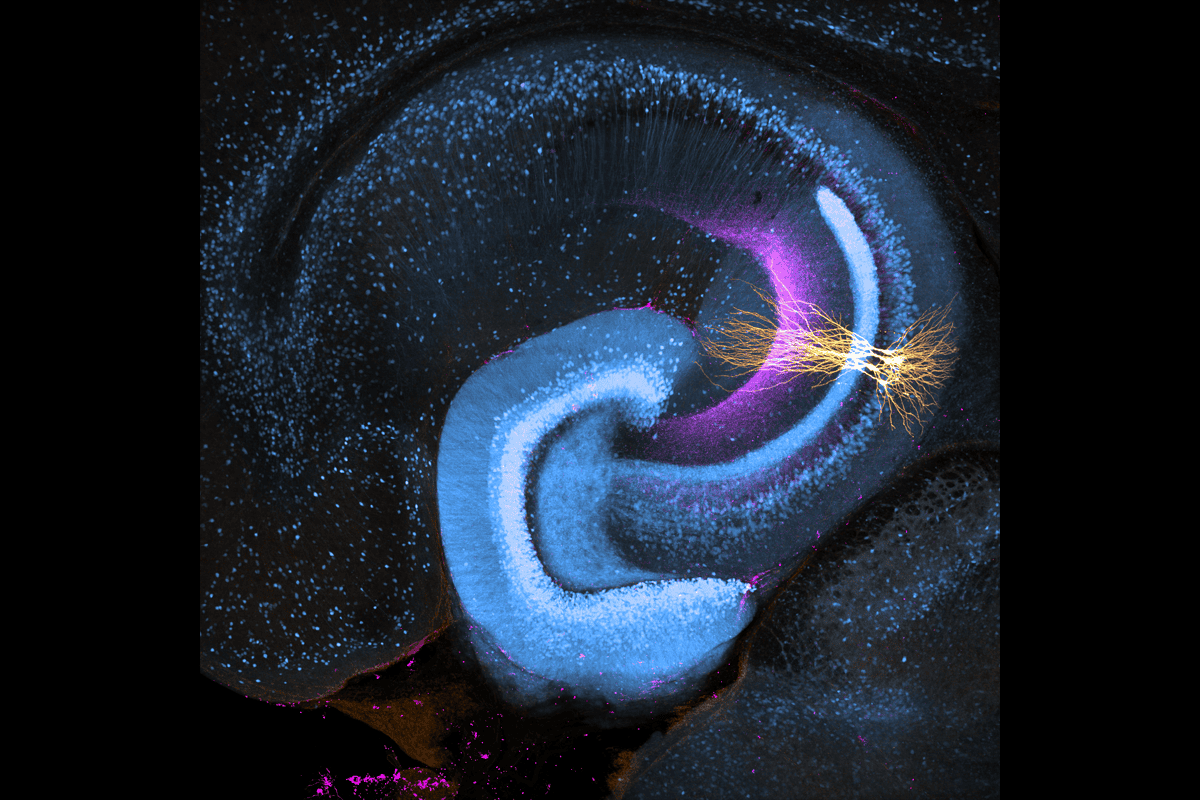St18-expressing neurons.