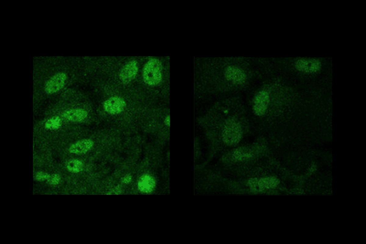 Research image of astrocytes.