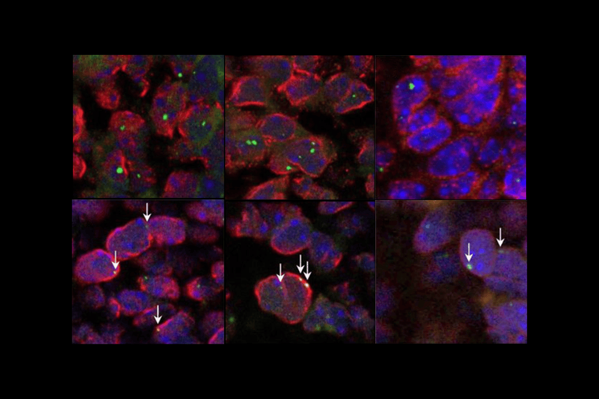 Research image of gene chromatin.