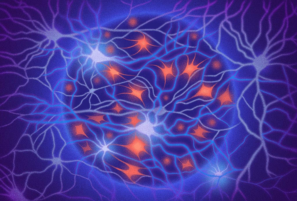 Astroengram pattern emerging from the center of an image of a classical neuronal pattern.