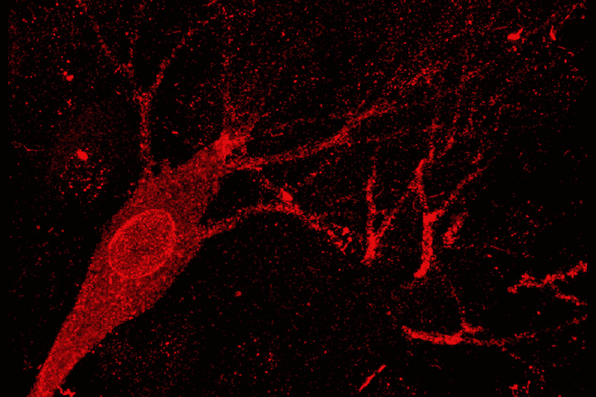 Neuron from a person with Alzheimer’s disease stained in red.