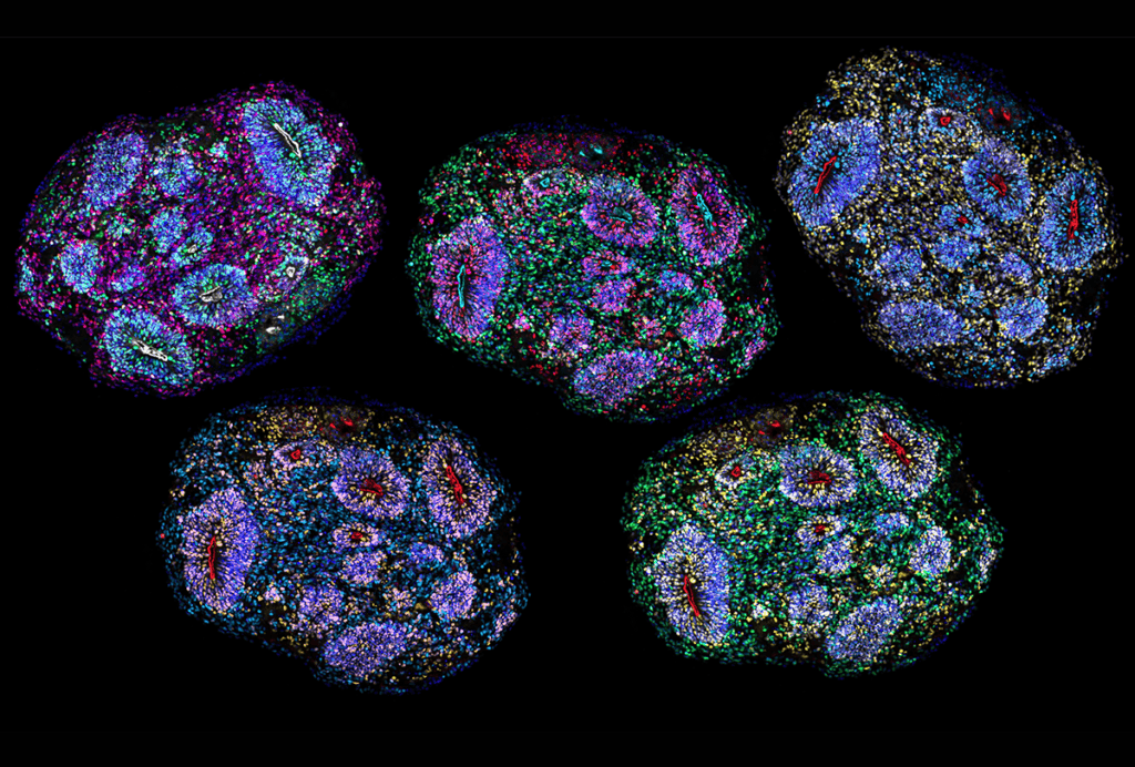 Cortical organoids.
