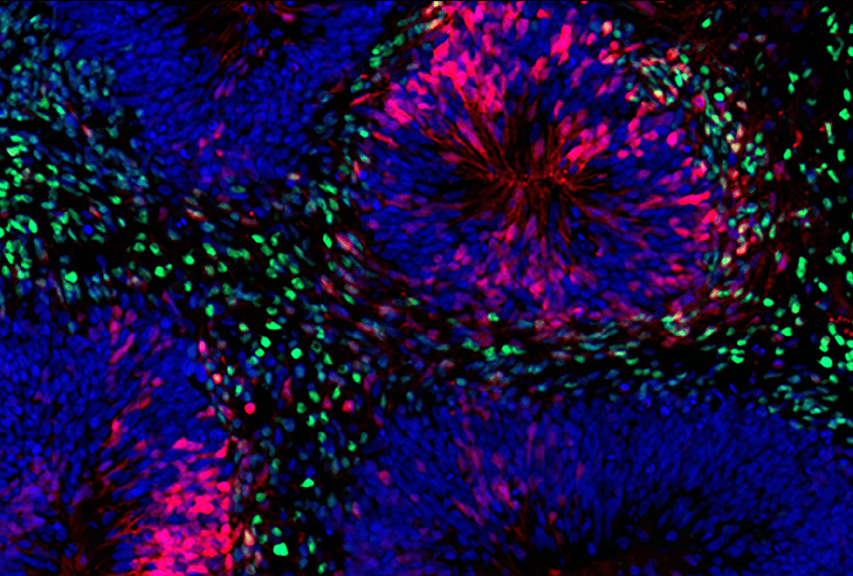 Progenitor cells from old organoids.
