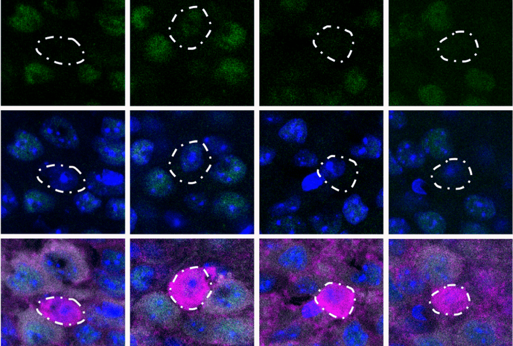 Research image of expression of MEIS2 in PV interneurons.