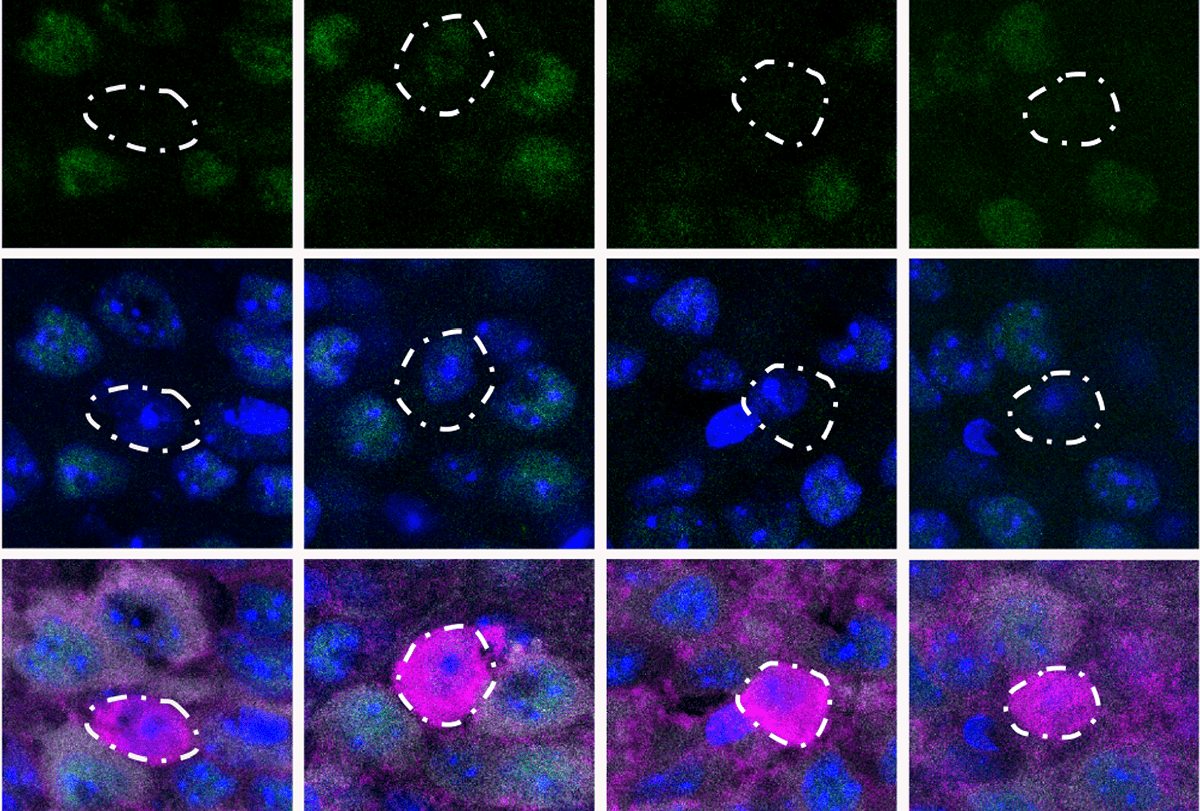 Research image of expression of MEIS2 in PV interneurons.