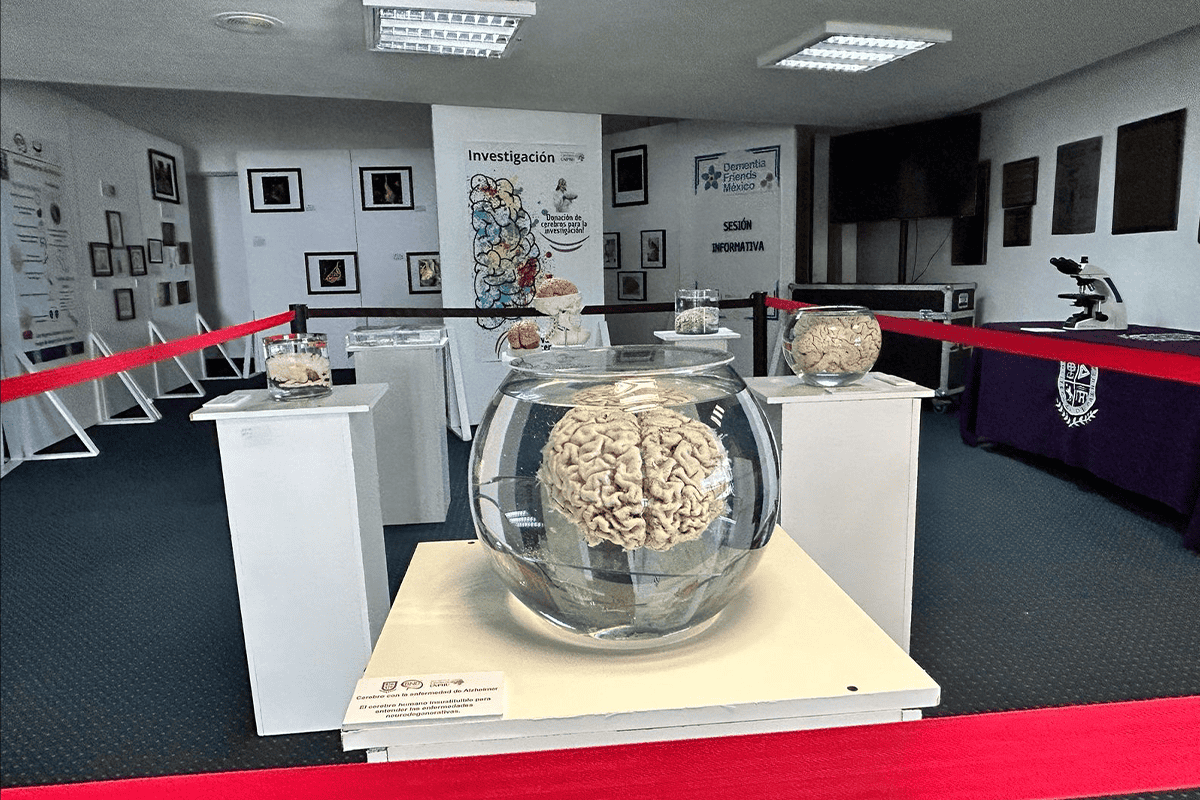 Museum exhibit includes brain in a bowl of water.