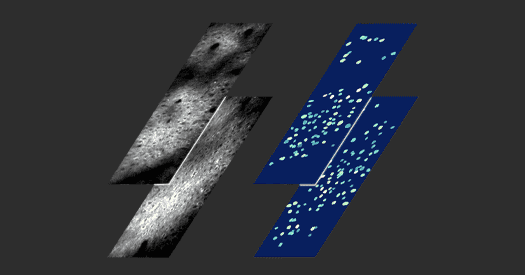Advances in Neural Imaging and Holographic Brain Microscopy - News Directory 3