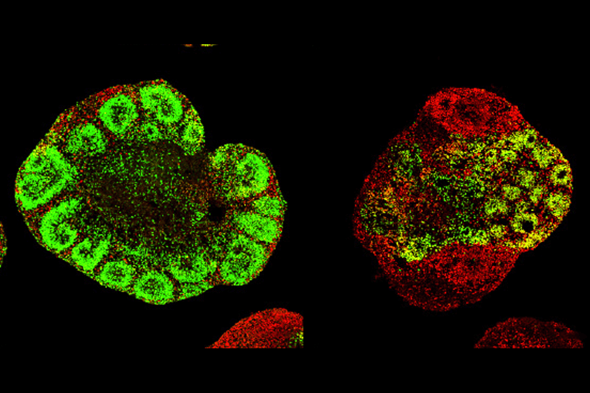 Cortical organoids from the anterior (green) or posterior (red) cortex.