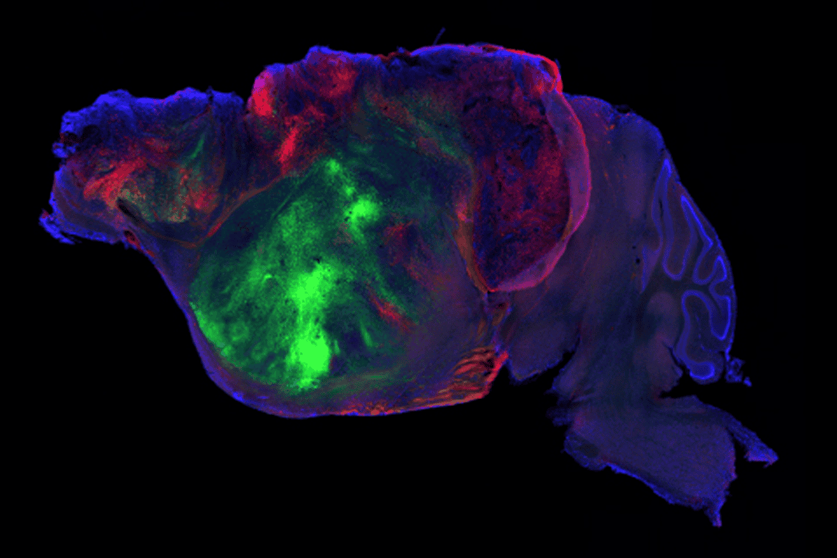 Nerve fibers from the human graft in mouse brain.