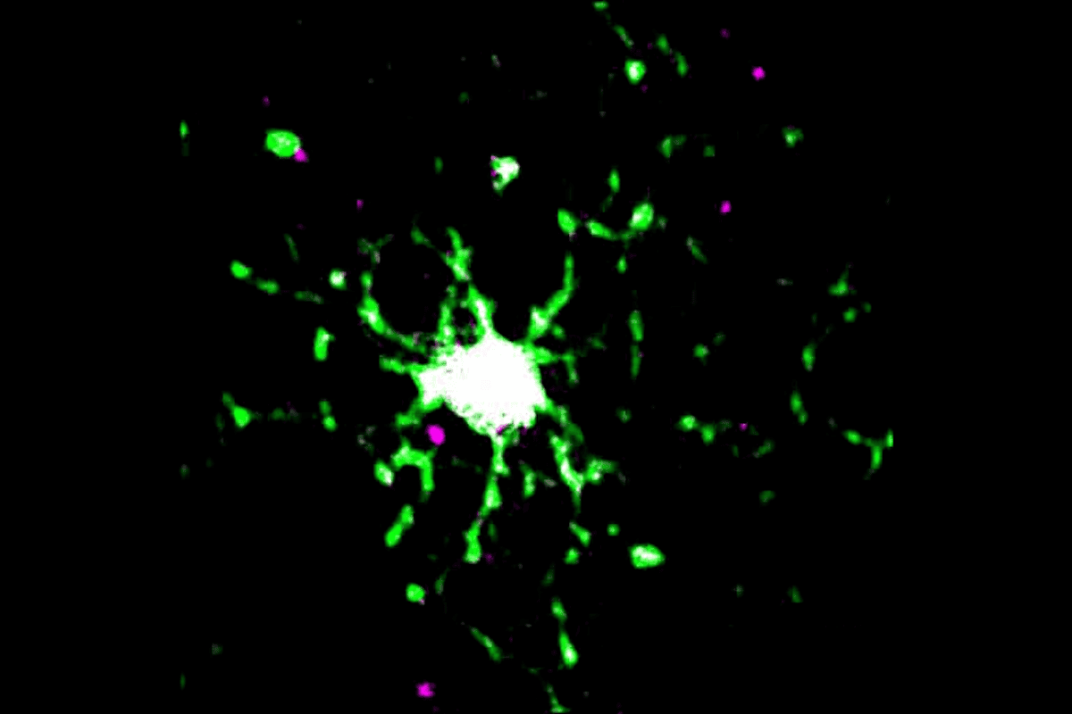 How Microglia Remove Waste From Inside Neurons - News Directory 3